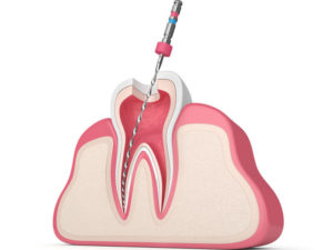 endodontia